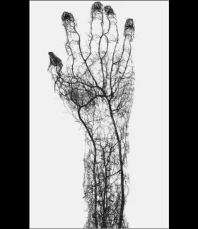 vaisseaux sanguins main